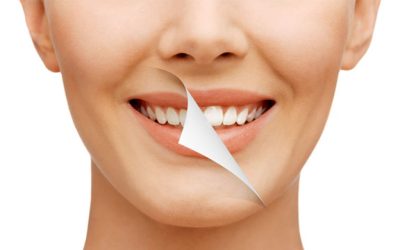 Choosing the Right Dentist in Whitby, Ontario – A Comprehensive Guide
